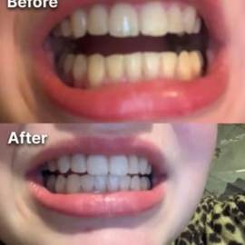 Manchas de café, antes y después