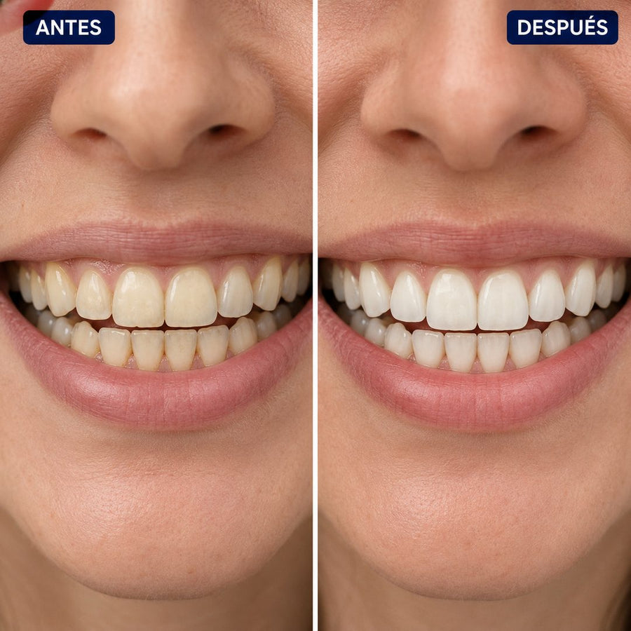 Antes y Después