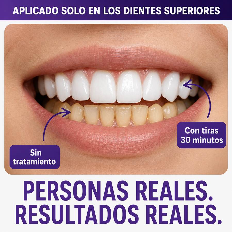 Purple Strips® — Tiras moradas que apagan el amarillo en 30 minutos