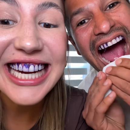 Purple Strips® — Tiras moradas que apagan el amarillo en 30 minutos