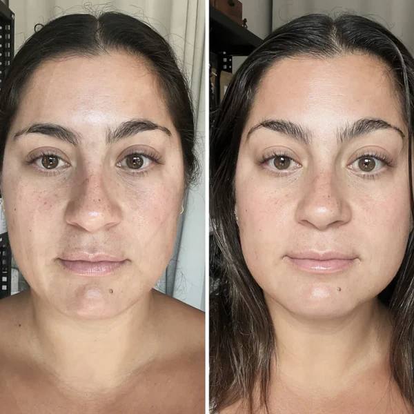 El cuello y la papada